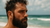 How Summer Affects Hair Follicles: What Every Bearded Guy Needs to Know